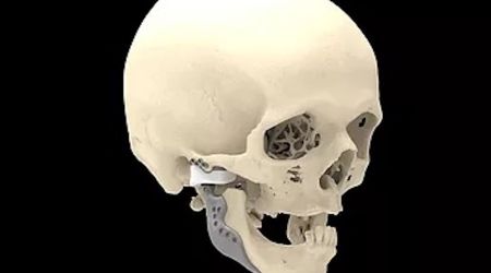 Temporomandibular Joint Specialists