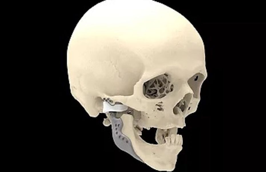 Temporomandibular Joint Specialists